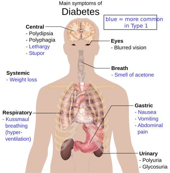 symptoms of diabetes