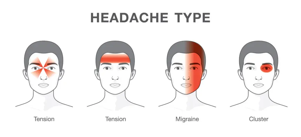 difference between headaches and migraine
