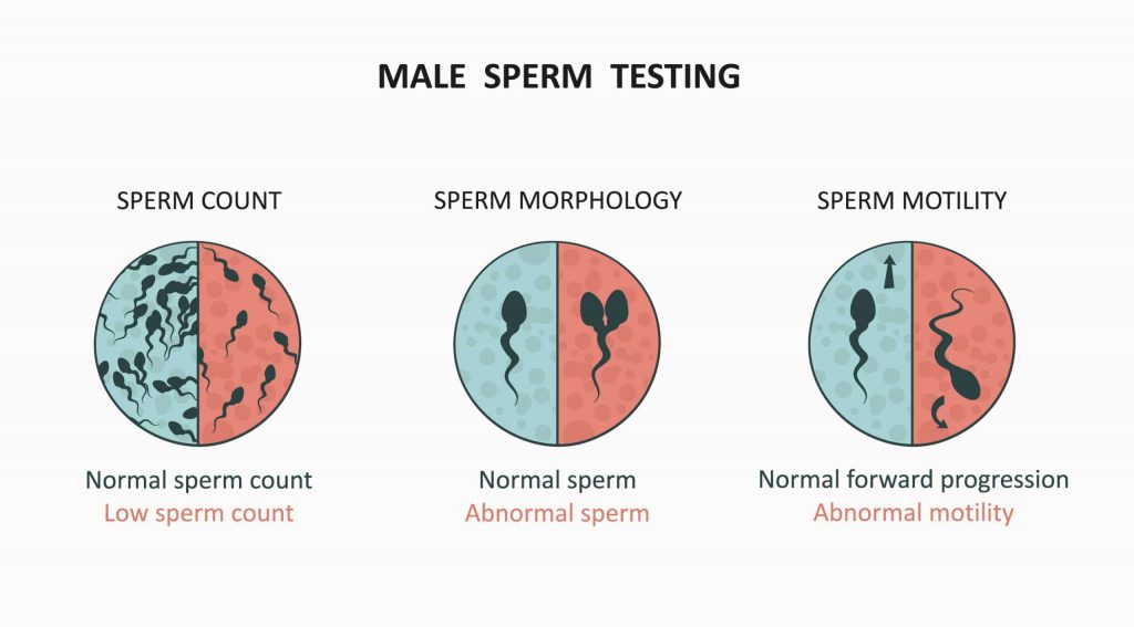 sperm testing in male infertility