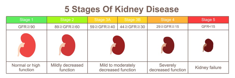 stages of kidney disease