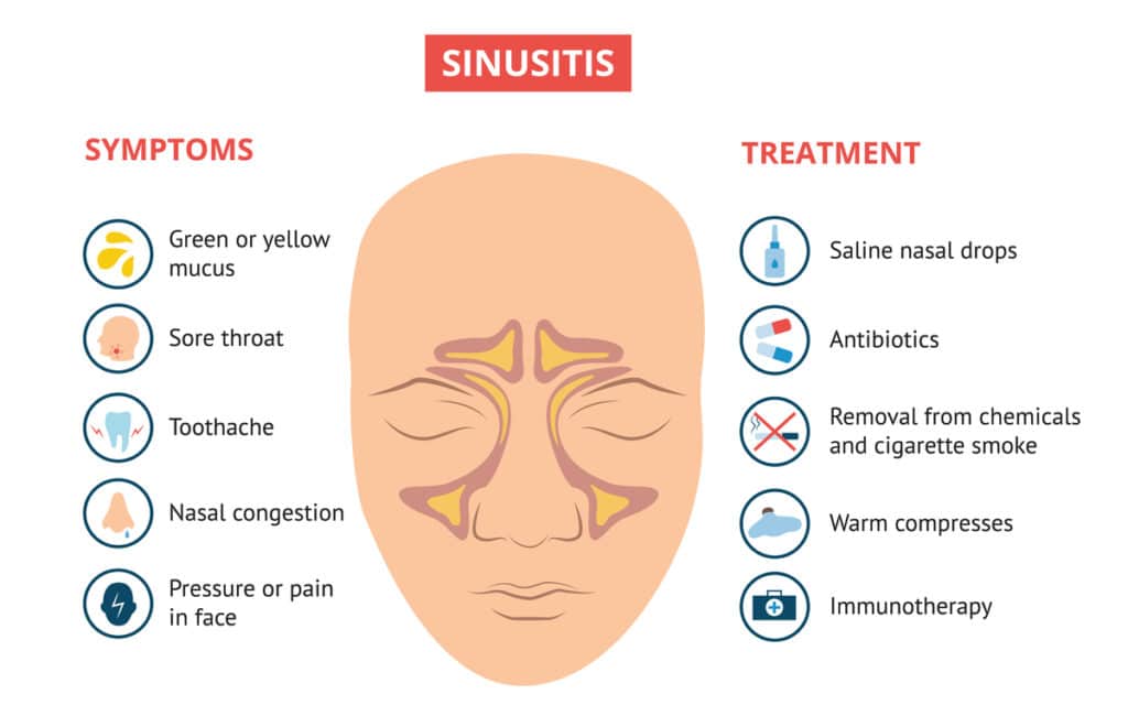 Treatment and symptoms of sinusitis
