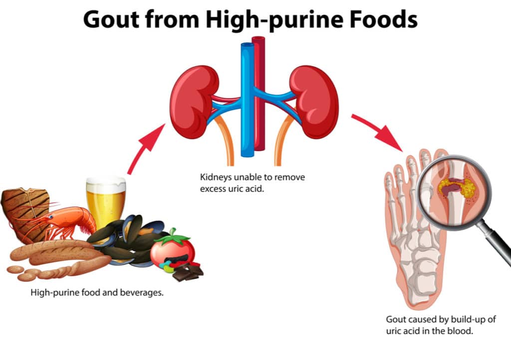 high purine foods gout