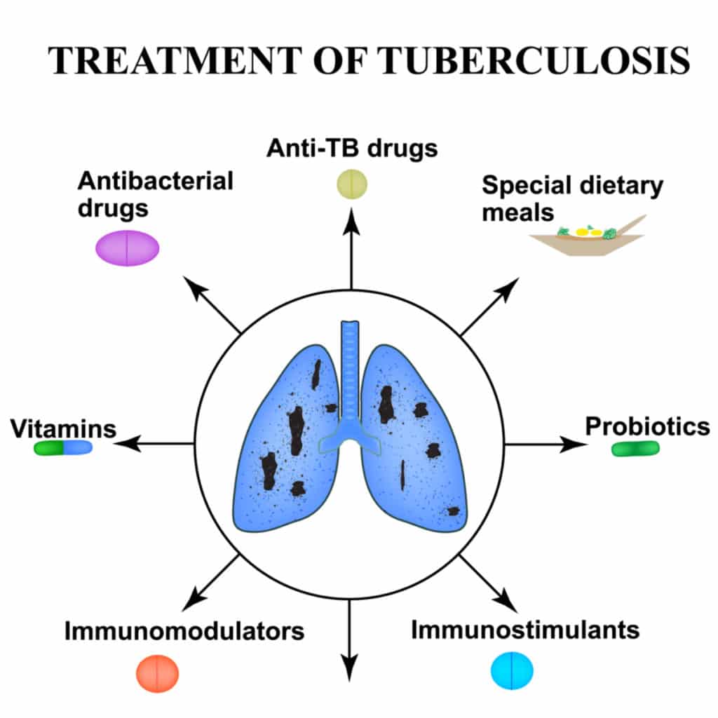 tuberculosis treatment